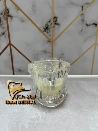 مولاژ